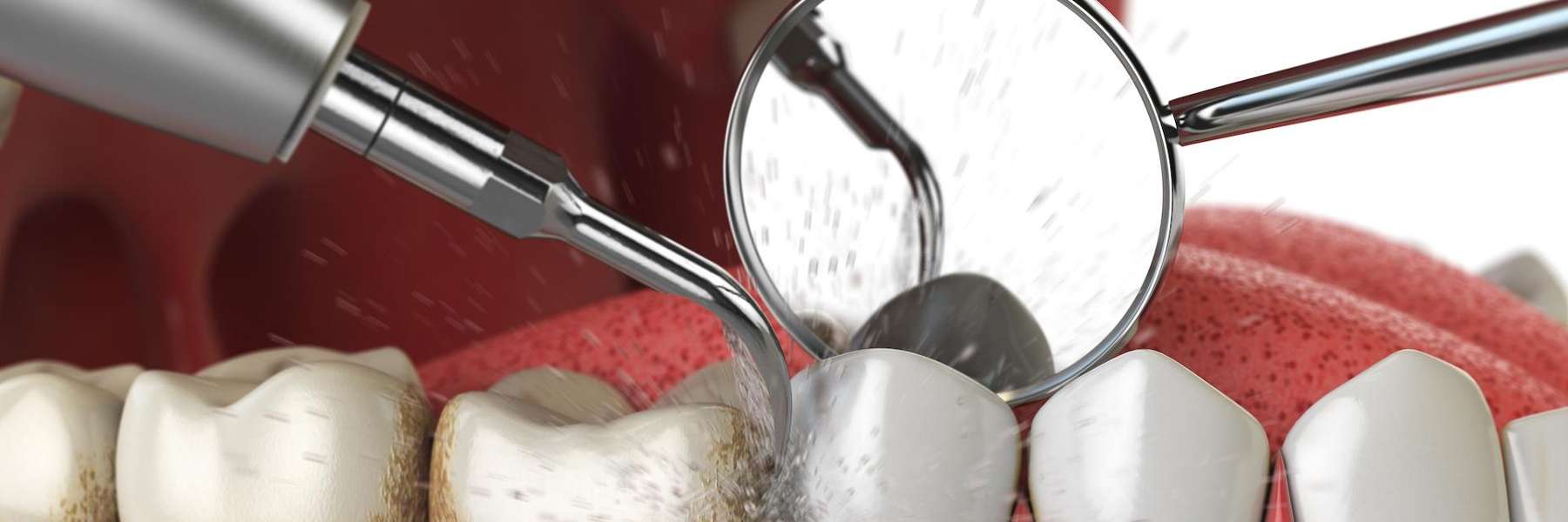 close up of dentist exam | cosmetic dentist brooklyn