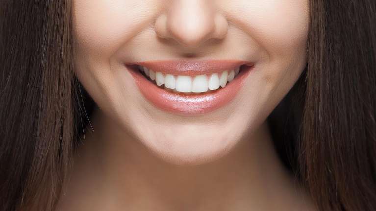 patient smiling with brown hair | cosmetic dentist dumbo