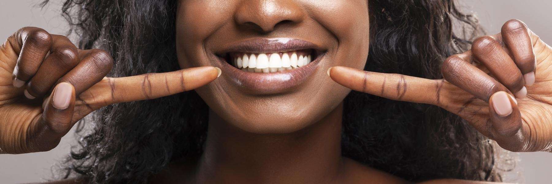 A smiling woman with professionally whitened teeth