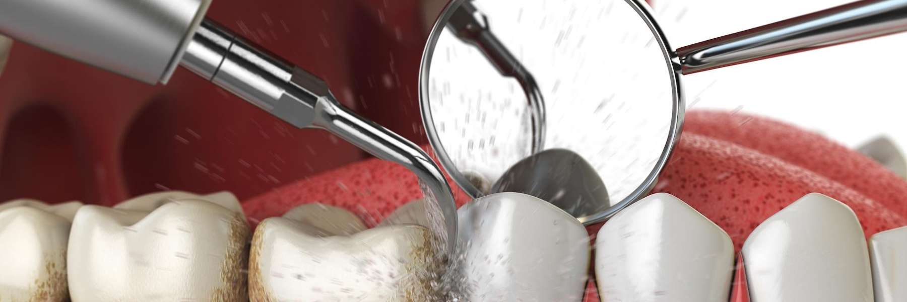 close up of dentist exam | dumbo dental